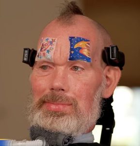 Steve Gleason